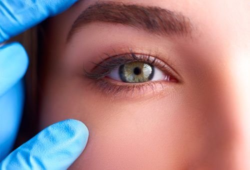 botox for undereyes