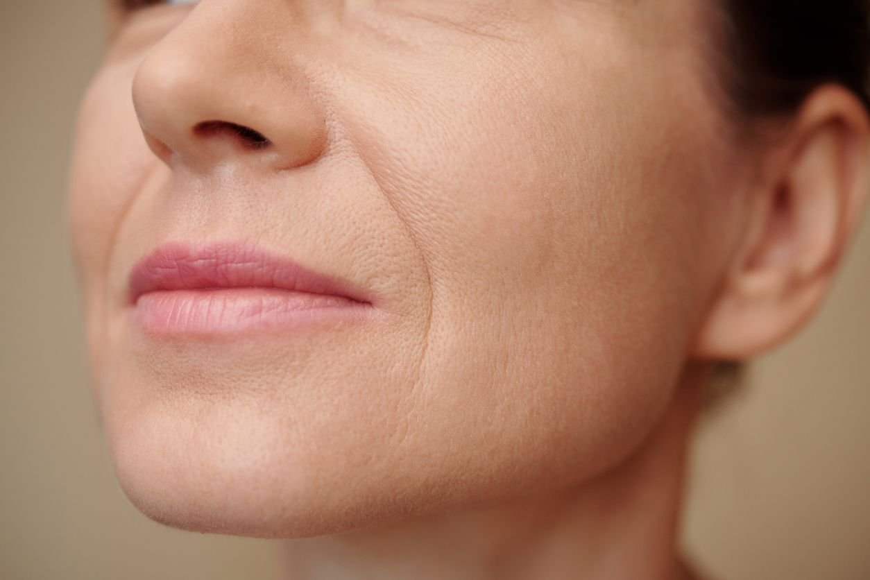 cheek filler care