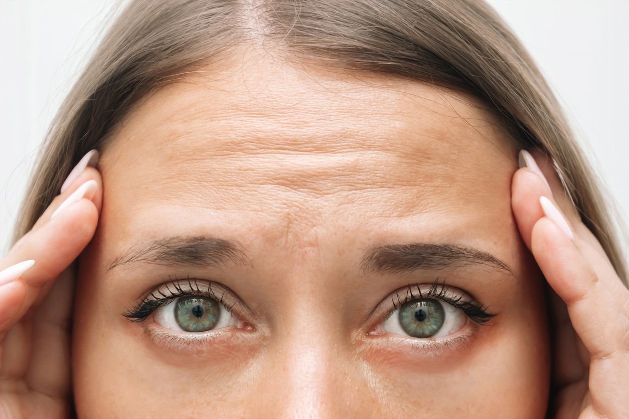 frown lines on face