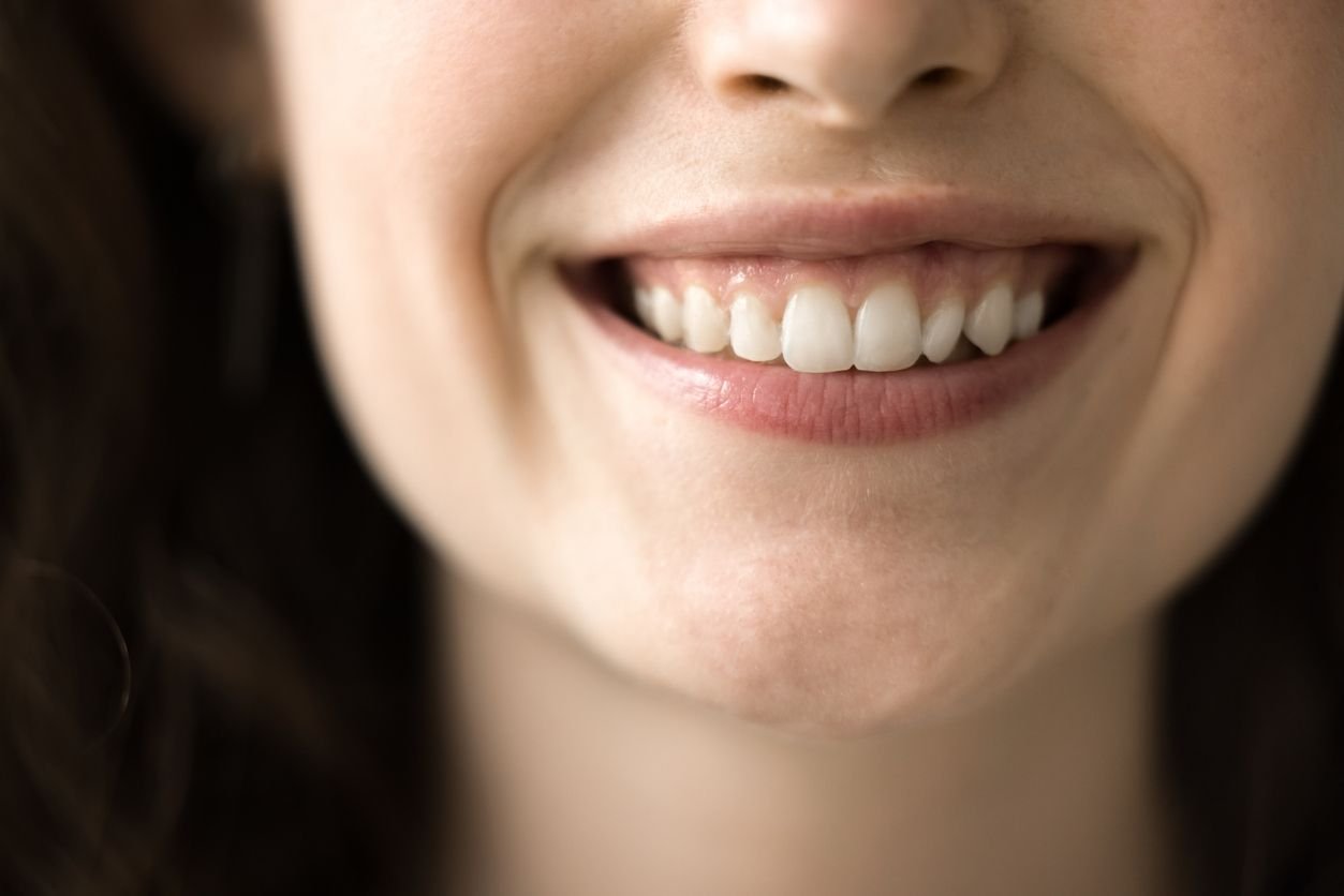 gummy smile fix
