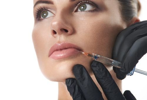 lip fillers last