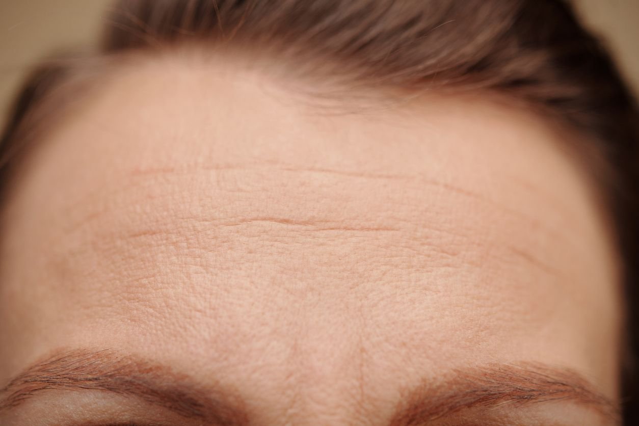 small forehead lines