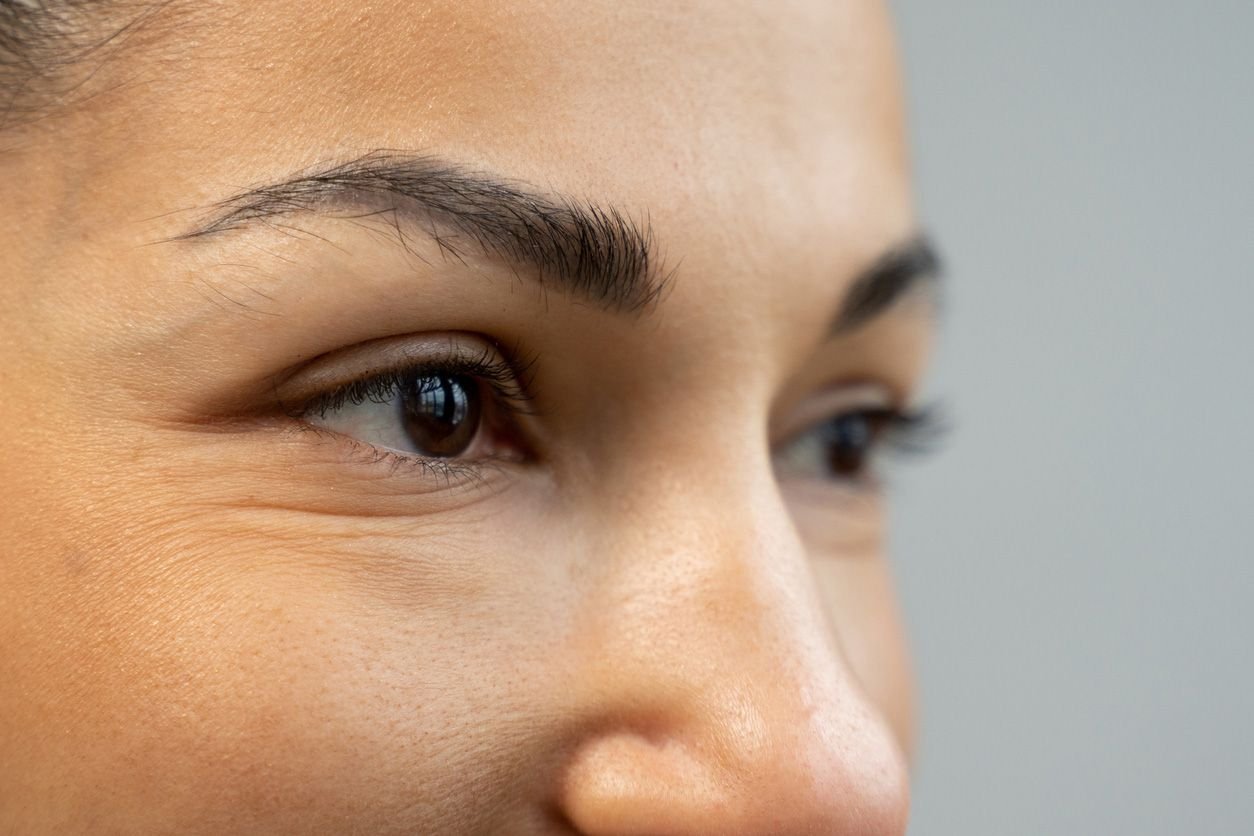 woman has eye bags