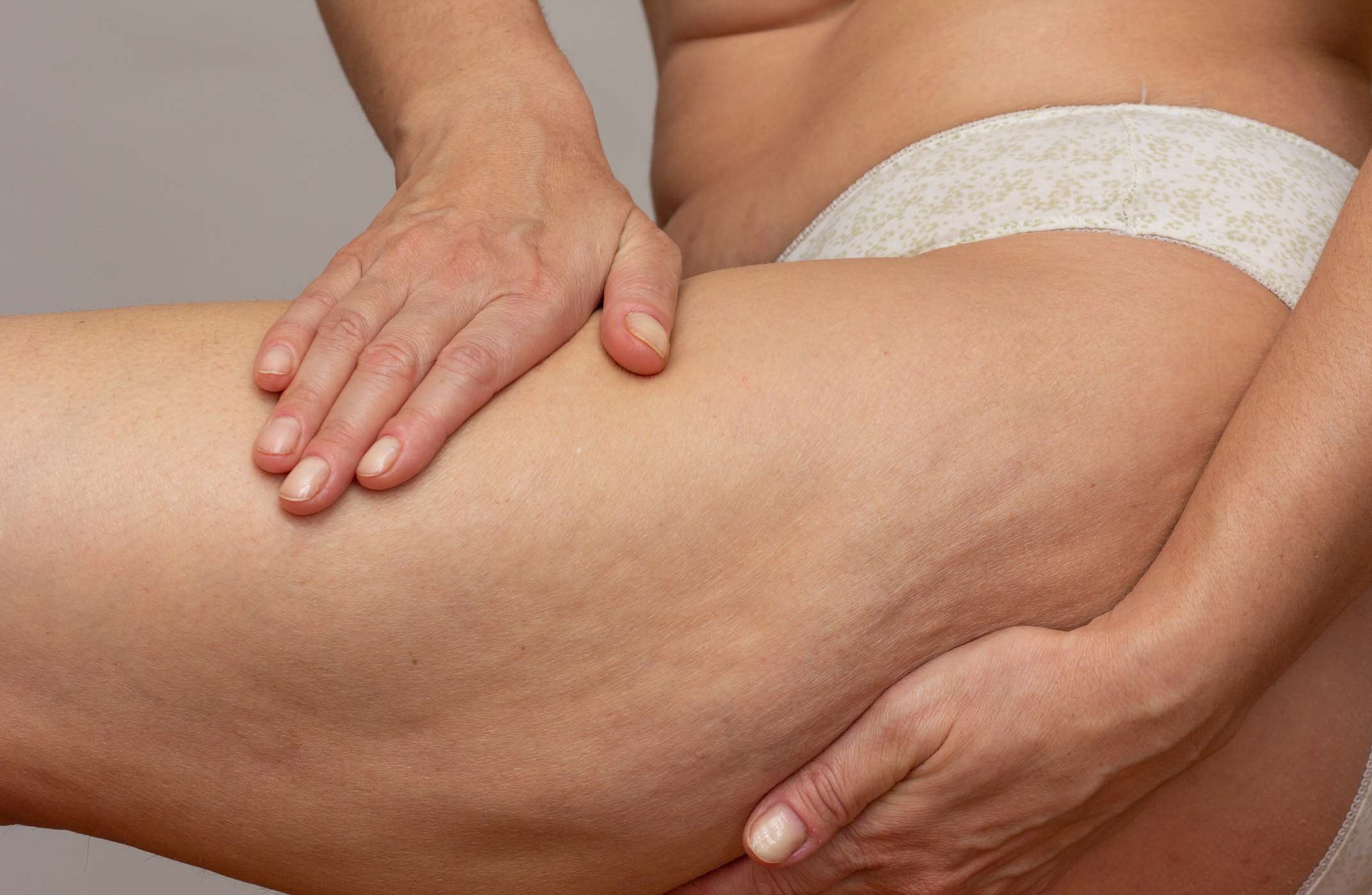 woman with fat on legs